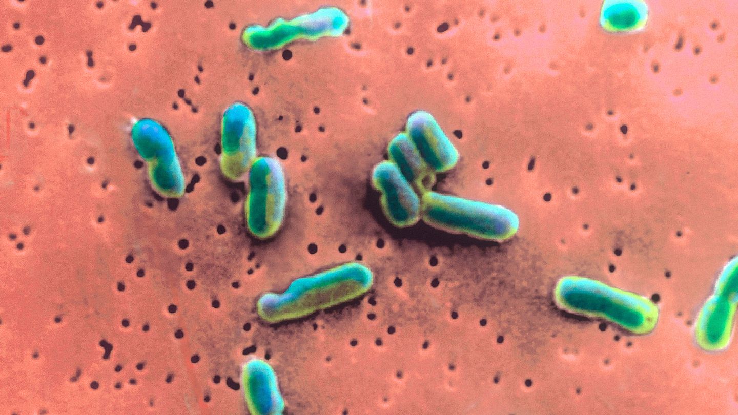 Les bactéries Shigella résistantes aux médicaments causent davantage d'infections de l'estomac